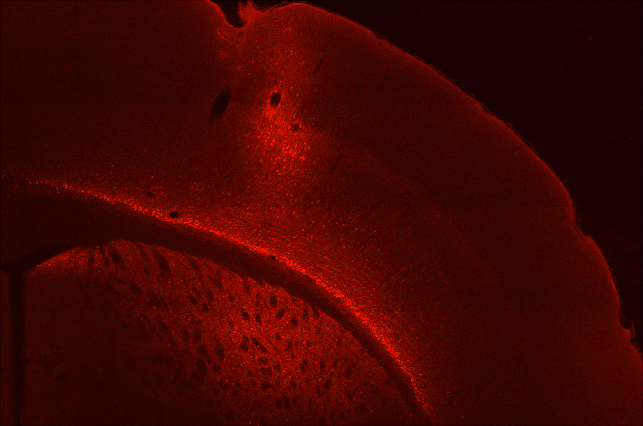 Addgene: AAV Data Hub - pAAV.Syn.NES-jRGECO1a.WPRE.SV40 in Mouse